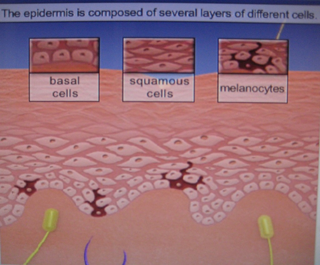 Skin Layers & Skin Cancer Cells